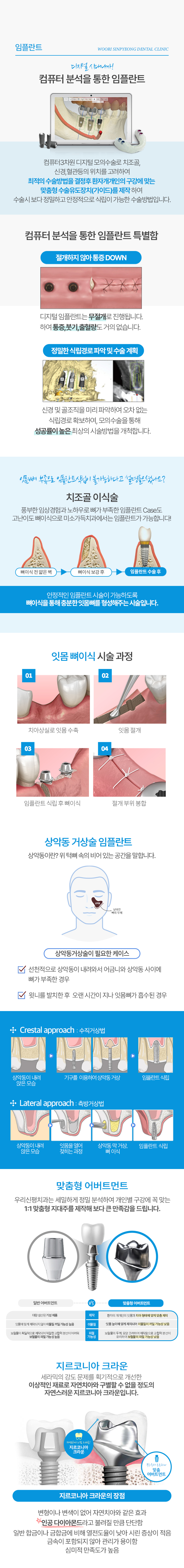 임플란트